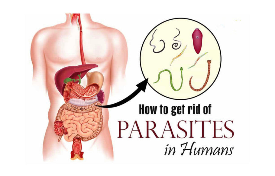 Parasite Cleansing: A Practical Guide to Supporting Your Body